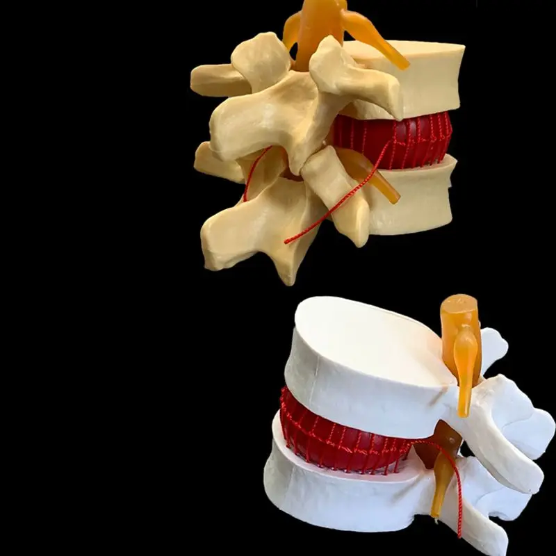 Anatomik İnsan Lomber Vertebra - Examination Bed Medical incelemesi ve fiyatı